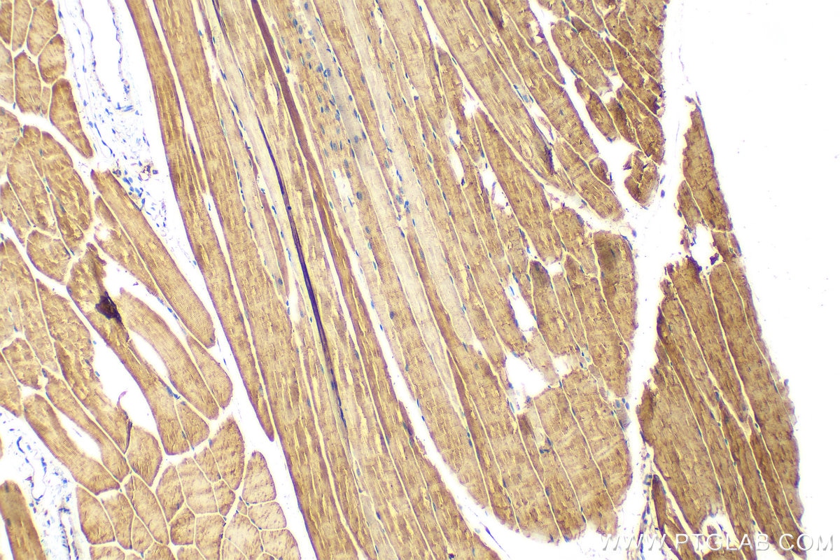 Immunohistochemistry (IHC) staining of mouse skeletal muscle tissue using PFKM Polyclonal antibody (55028-1-AP)