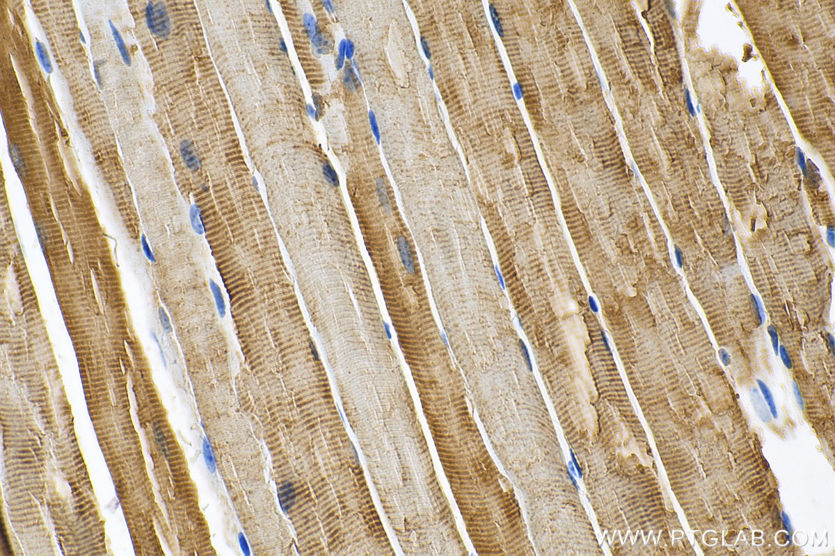 Immunohistochemistry (IHC) staining of mouse skeletal muscle tissue using PFKM Polyclonal antibody (55028-1-AP)