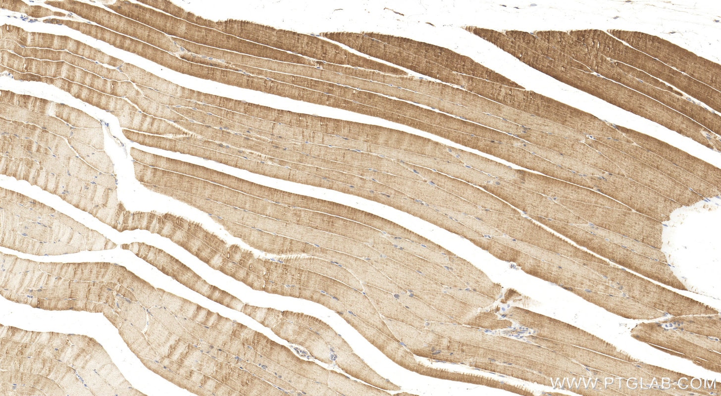 Immunohistochemistry (IHC) staining of mouse skeletal muscle tissue using PFKM Polyclonal antibody (55028-1-AP)