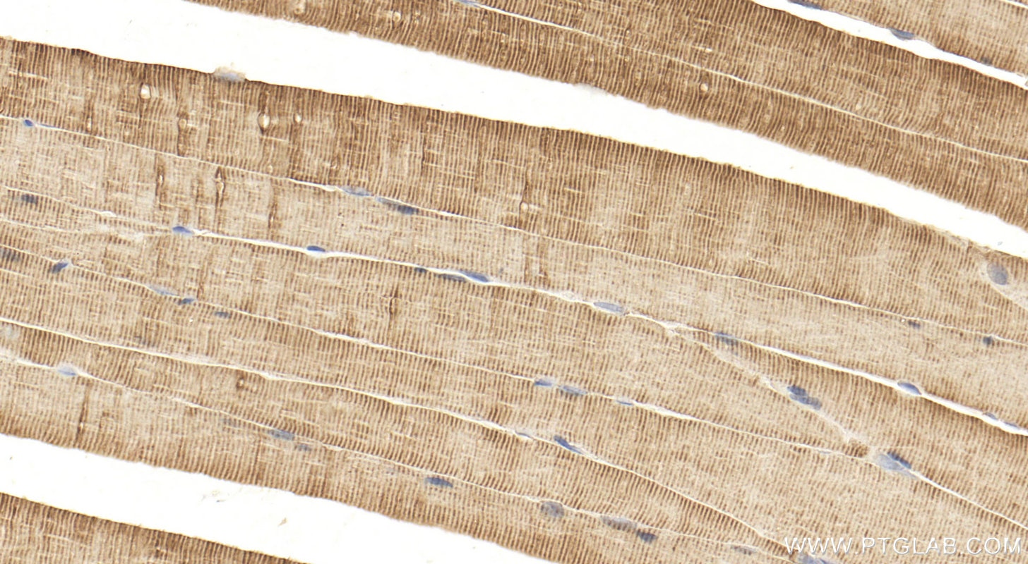 Immunohistochemistry (IHC) staining of mouse skeletal muscle tissue using PFKM Polyclonal antibody (55028-1-AP)