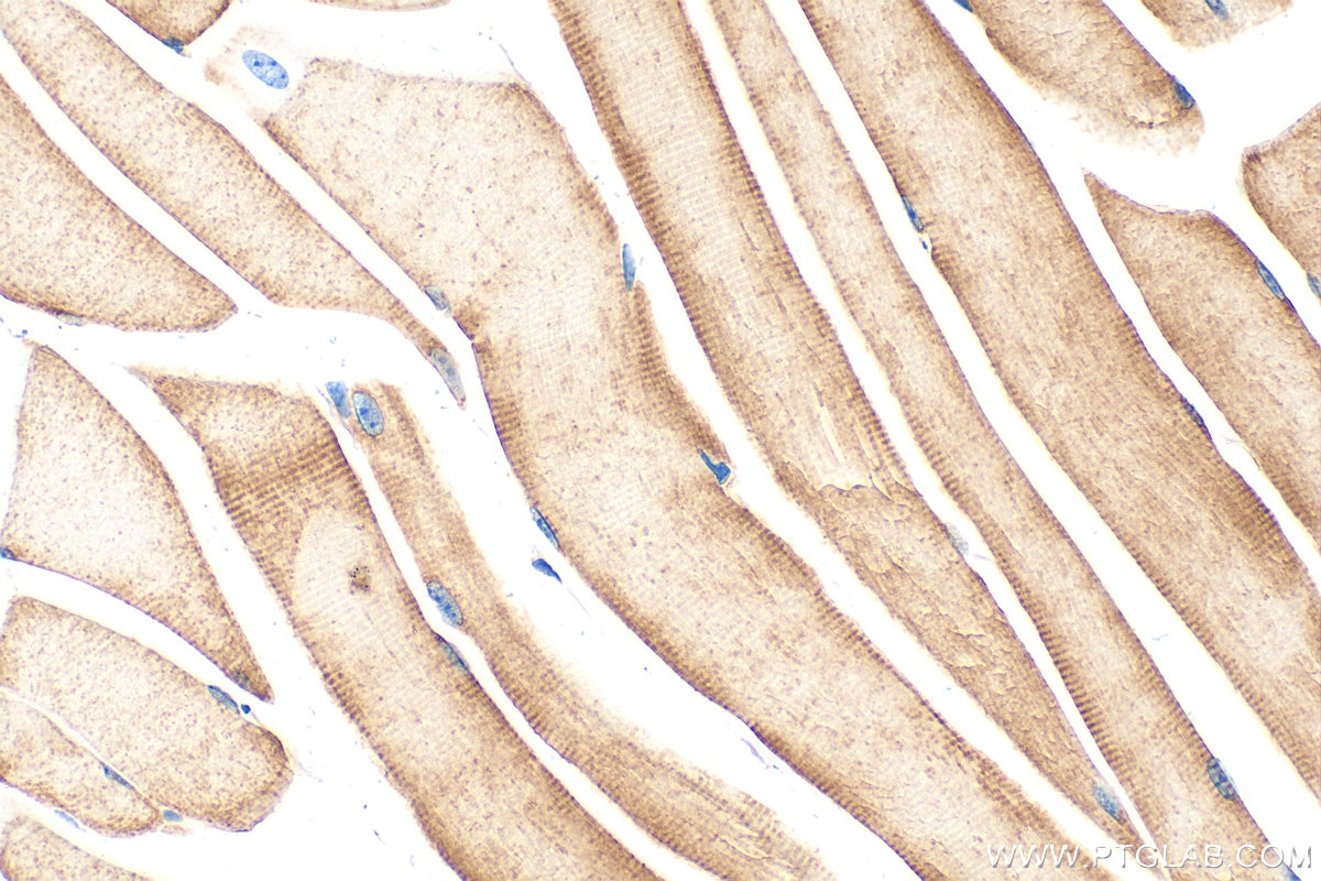 Immunohistochemistry (IHC) staining of mouse skeletal muscle tissue using PFKM Polyclonal antibody (55028-1-AP)