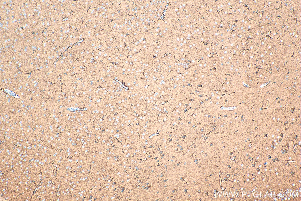 Immunohistochemistry (IHC) staining of mouse brain tissue using PFKM Polyclonal antibody (55028-1-AP)