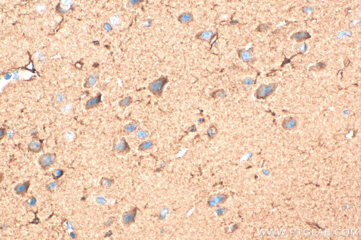 Immunohistochemistry (IHC) staining of mouse brain tissue using PFKM Polyclonal antibody (55028-1-AP)