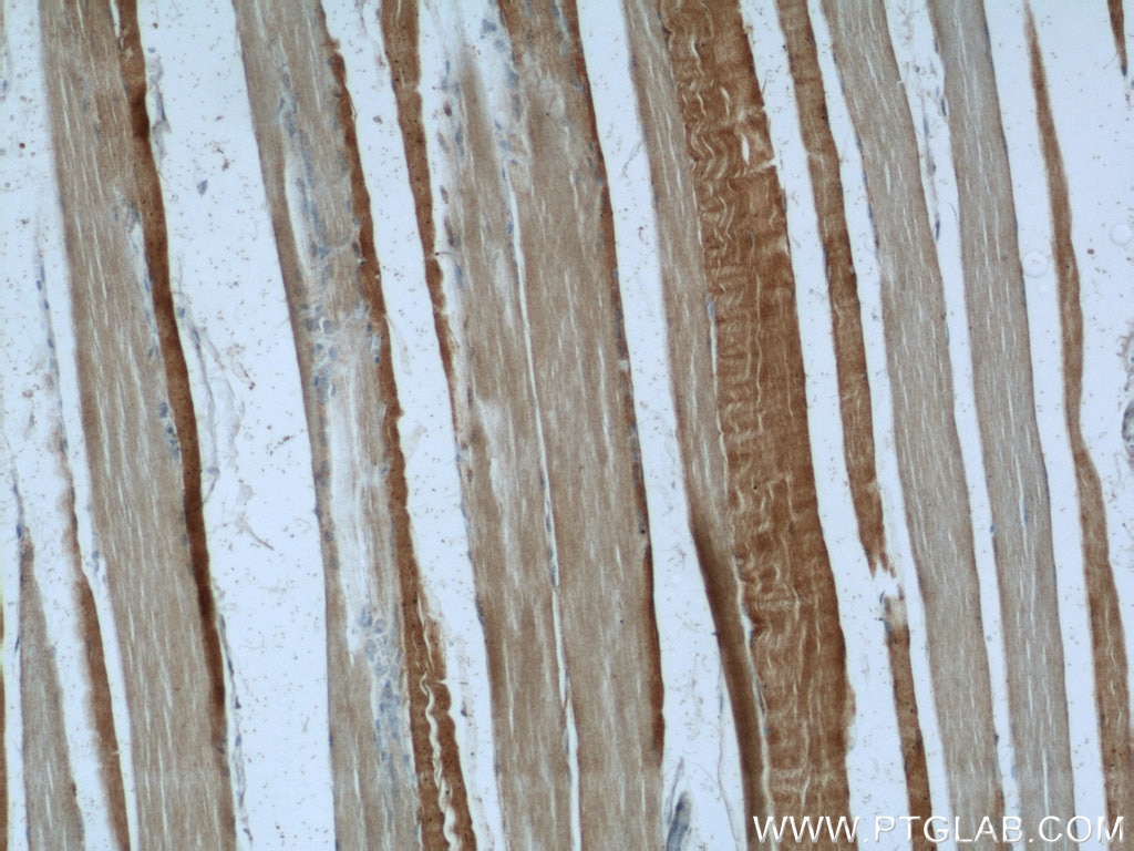 Immunohistochemistry (IHC) staining of human skeletal muscle tissue using PFKM Polyclonal antibody (55028-1-AP)