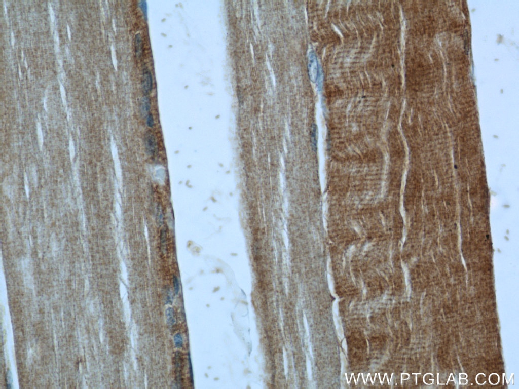 IHC staining of human skeletal muscle using 55028-1-AP