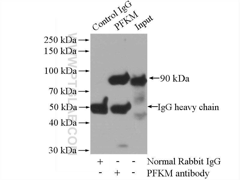 Immunoprecipitation (IP) experiment of mouse skeletal muscle tissue using PFKM Polyclonal antibody (55028-1-AP)