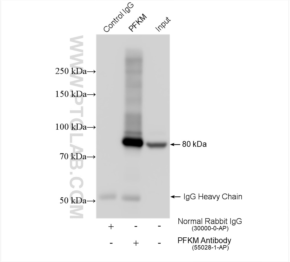 Immunoprecipitation (IP) experiment of mouse heart tissue using PFKM Polyclonal antibody (55028-1-AP)