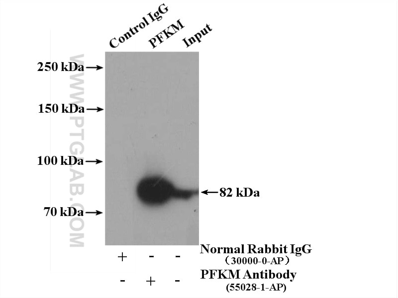 Immunoprecipitation (IP) experiment of mouse liver tissue using PFKM Polyclonal antibody (55028-1-AP)