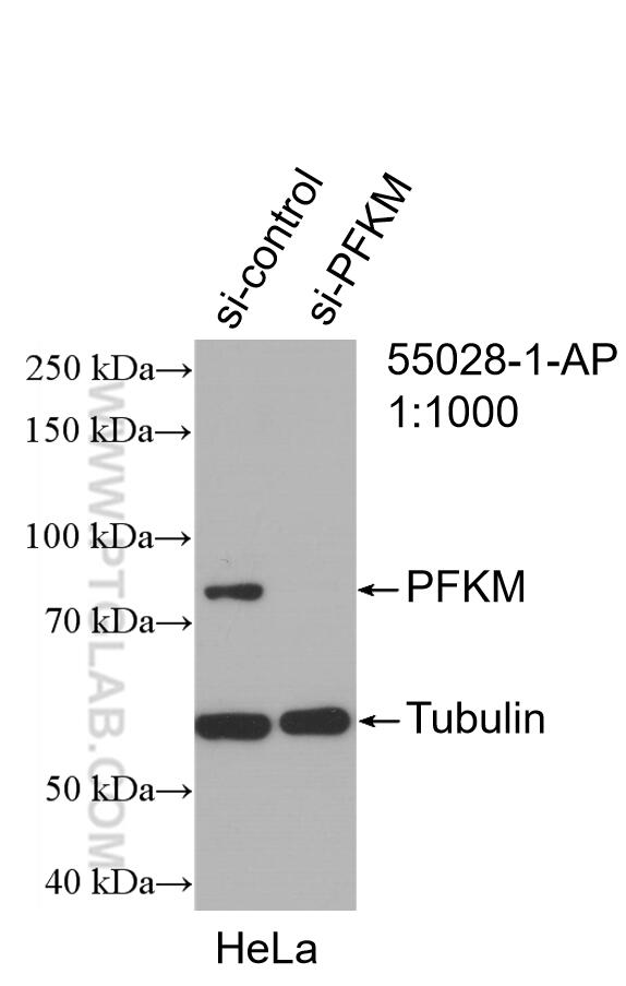 Western Blot (WB) analysis of HeLa cells using PFKM Polyclonal antibody (55028-1-AP)