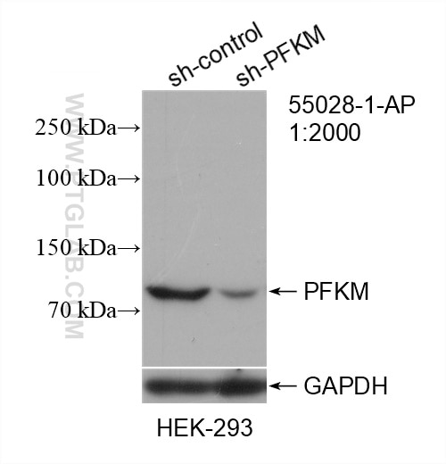 Western Blot (WB) analysis of HEK-293 cells using PFKM Polyclonal antibody (55028-1-AP)