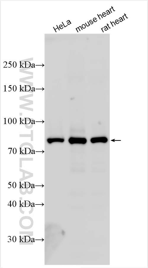 Western Blot (WB) analysis of various lysates using PFKM Polyclonal antibody (55028-1-AP)