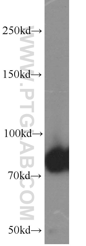 Western Blot (WB) analysis of human skeletal muscle tissue using PFKM Polyclonal antibody (55028-1-AP)