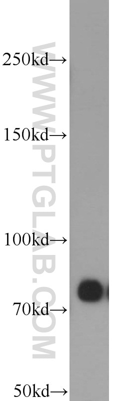 Western Blot (WB) analysis of HepG2 cells using PFKM Polyclonal antibody (55028-1-AP)