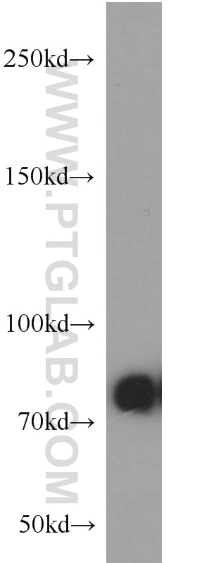 Western Blot (WB) analysis of human brain tissue using PFKM Polyclonal antibody (55028-1-AP)