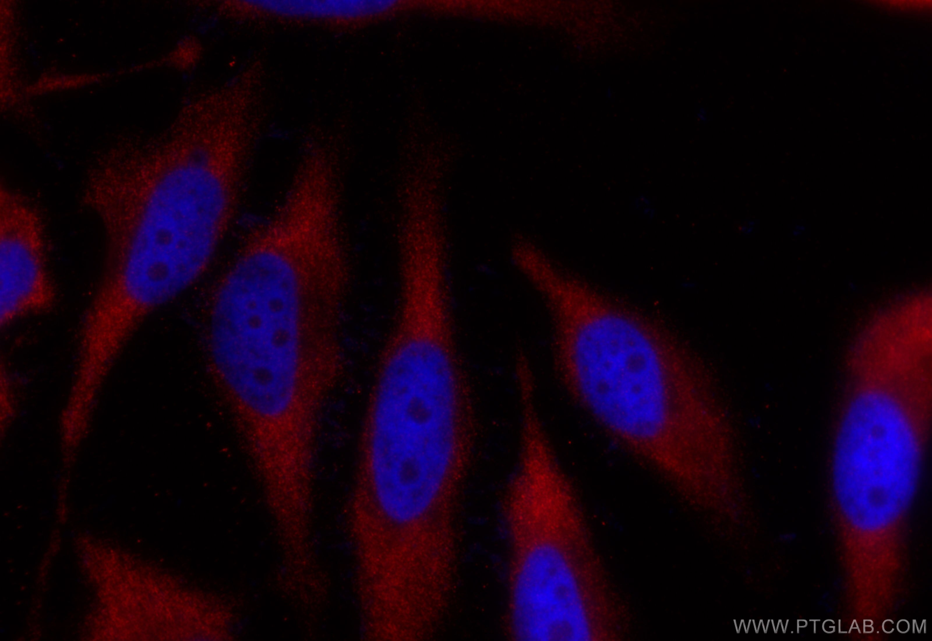Immunofluorescence (IF) / fluorescent staining of HeLa cells using PFKM Recombinant antibody (84281-5-RR)