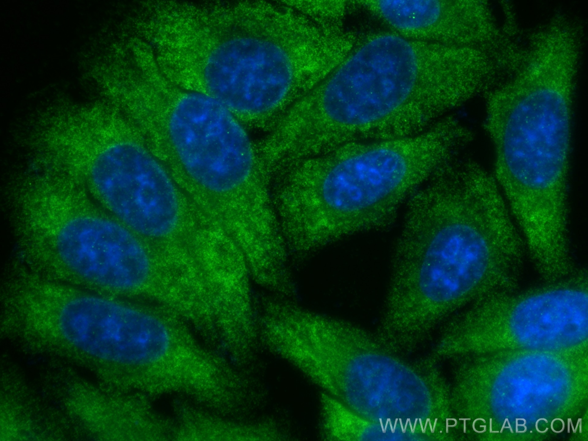 Immunofluorescence (IF) / fluorescent staining of HepG2 cells using PFKM Recombinant antibody (84281-5-RR)