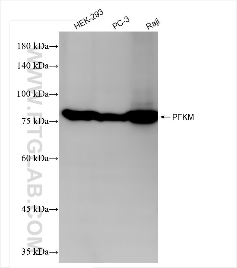 Western Blot (WB) analysis of various lysates using PFKM Recombinant antibody (84281-5-RR)