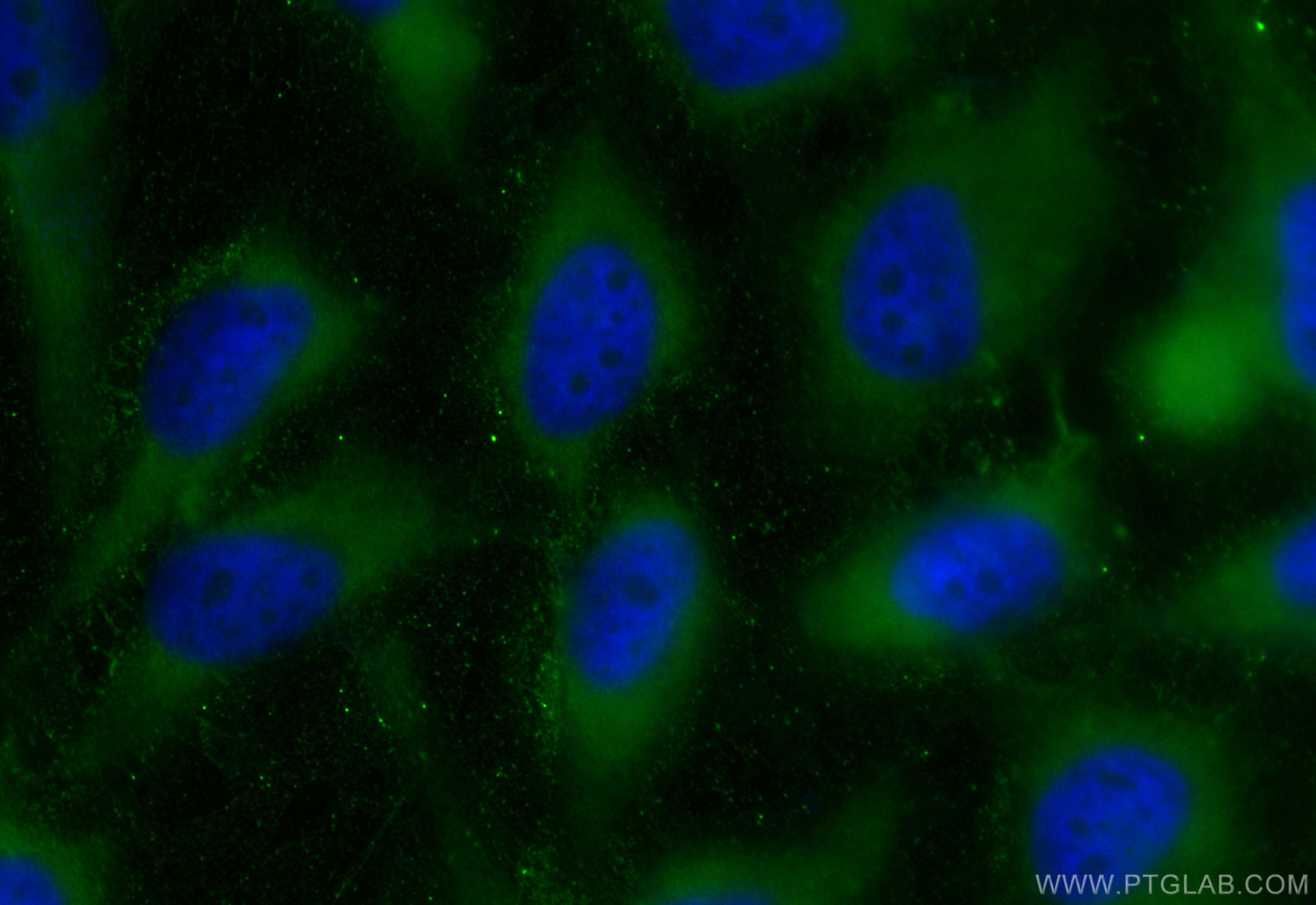 Immunofluorescence (IF) / fluorescent staining of HeLa cells using CoraLite® Plus 488-conjugated PFKM Recombinant ant (CL488-84281-5)