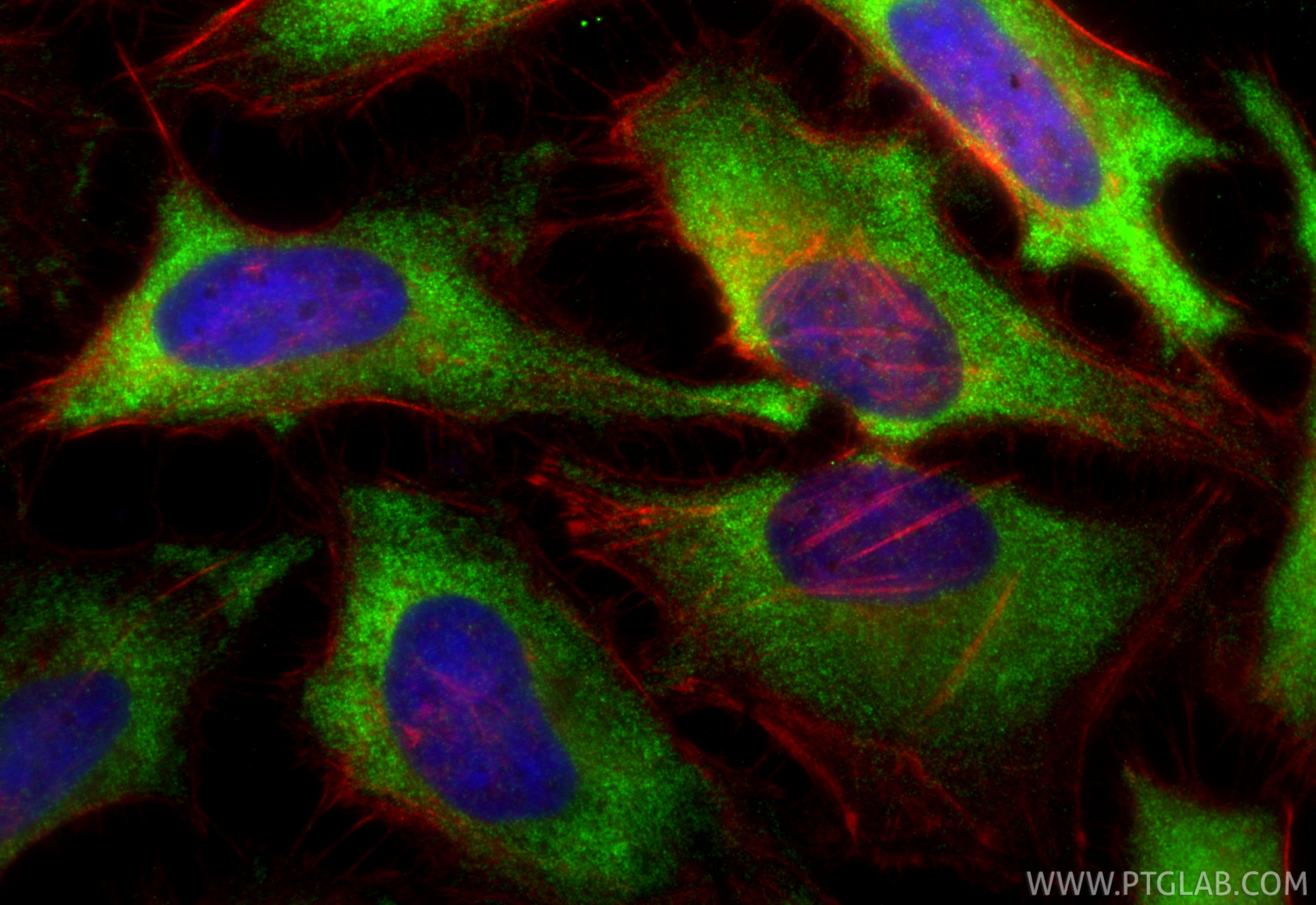 Immunofluorescence (IF) / fluorescent staining of HeLa cells using Multi-rAb™ PFKM Multi-Recombinant antibody (RMX00037)