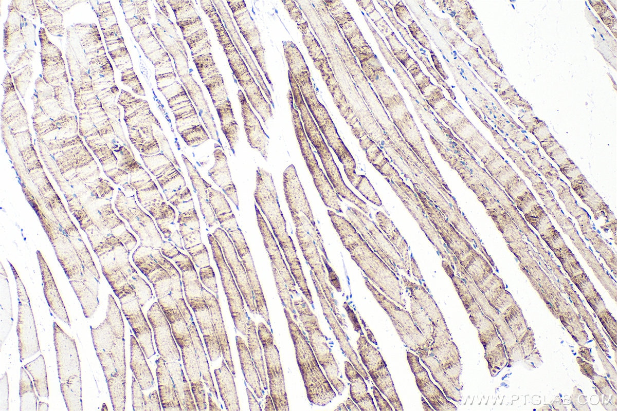 Immunohistochemistry (IHC) staining of mouse skeletal muscle tissue using Multi-rAb™ PFKM Multi-Recombinant antibody (RMX00037)