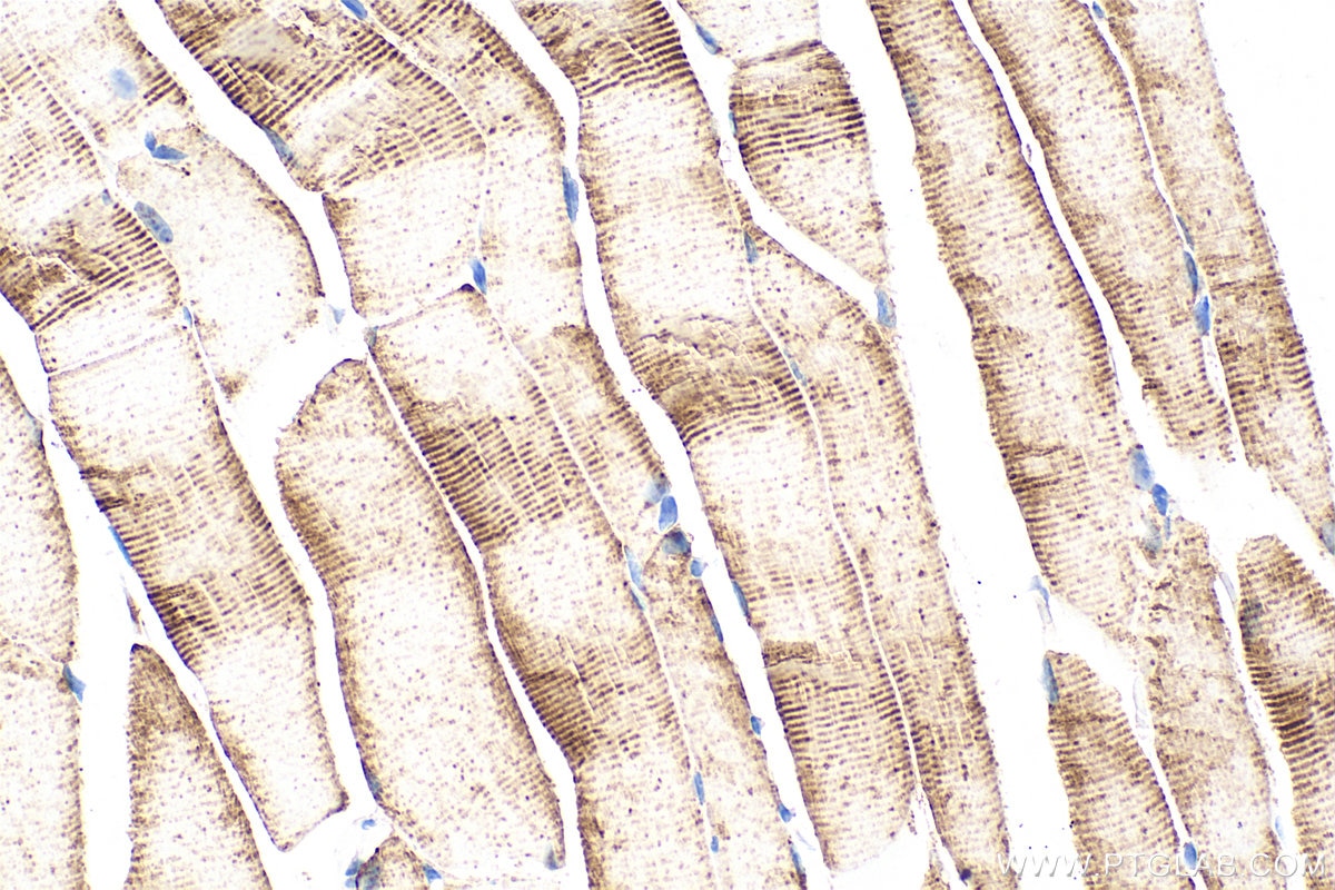 Immunohistochemistry (IHC) staining of mouse skeletal muscle tissue using Multi-rAb™ PFKM Multi-Recombinant antibody (RMX00037)