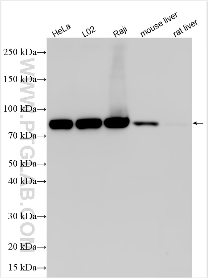 Western Blot (WB) analysis of various lysates using Multi-rAb™ PFKM Multi-Recombinant antibody (RMX00037)