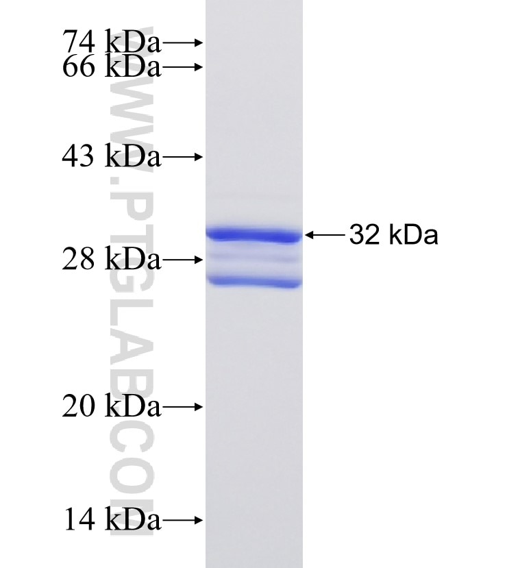 PFKM fusion protein Ag30840 SDS-PAGE