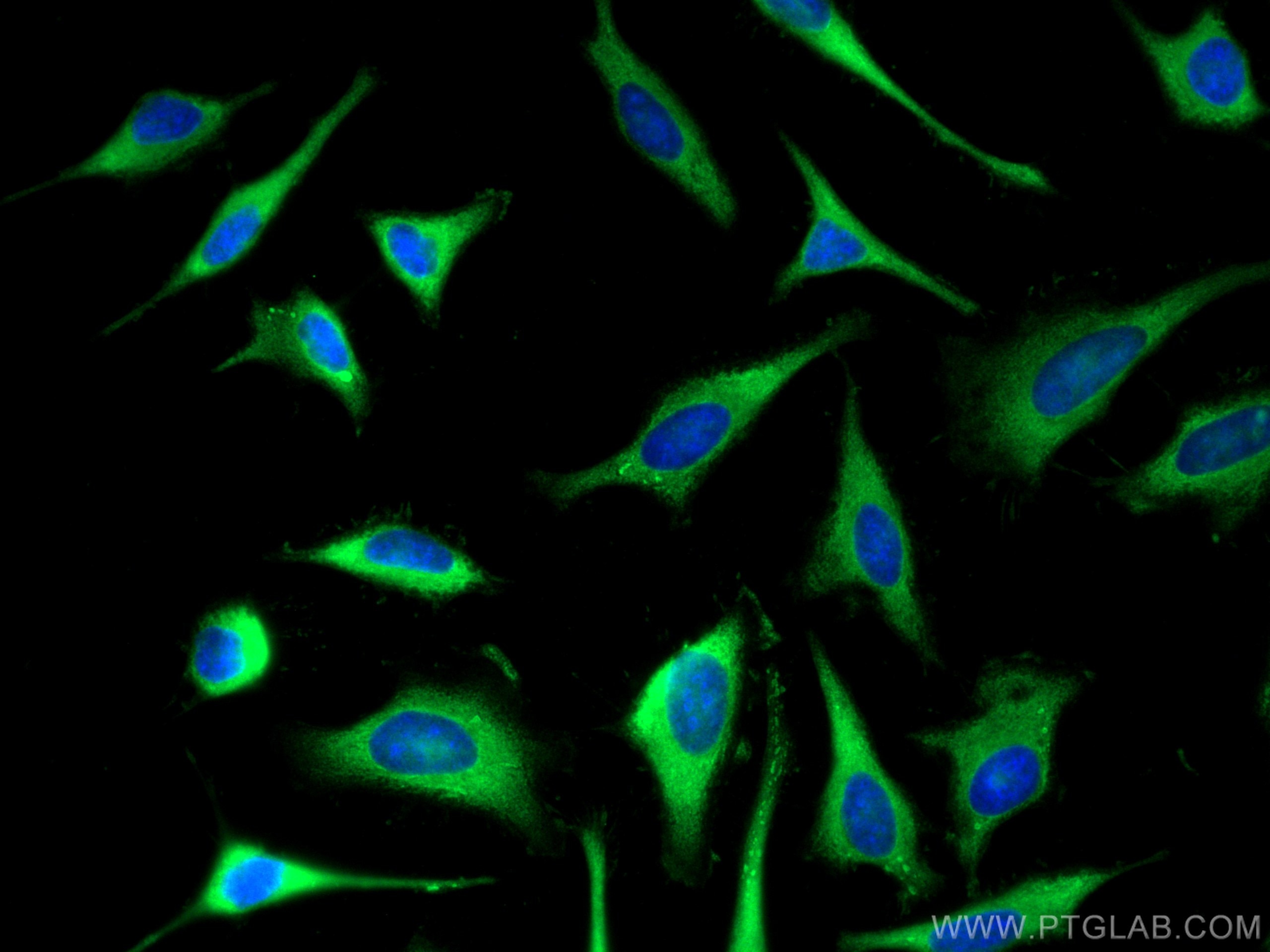 Immunofluorescence (IF) / fluorescent staining of HeLa cells using PFKP Polyclonal antibody (13389-1-AP)