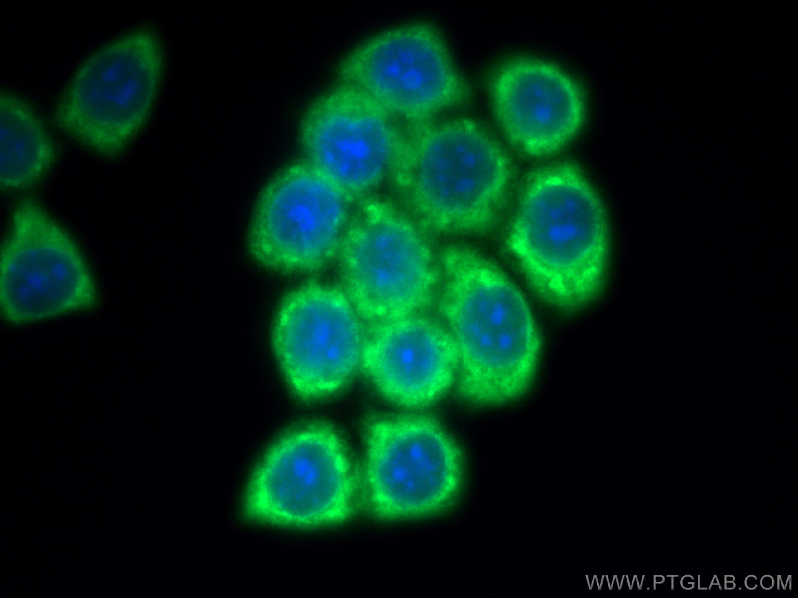 Immunofluorescence (IF) / fluorescent staining of BxPC-3 cells using PFKP Polyclonal antibody (13389-1-AP)