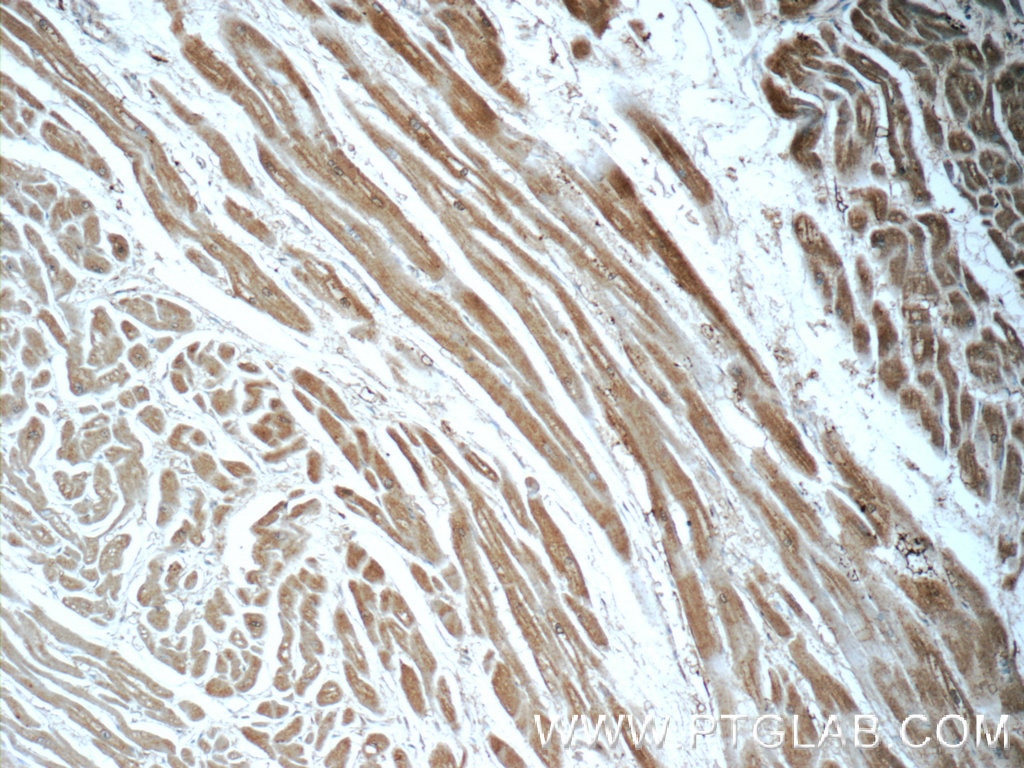 Immunohistochemistry (IHC) staining of human heart tissue using PFKP Polyclonal antibody (13389-1-AP)