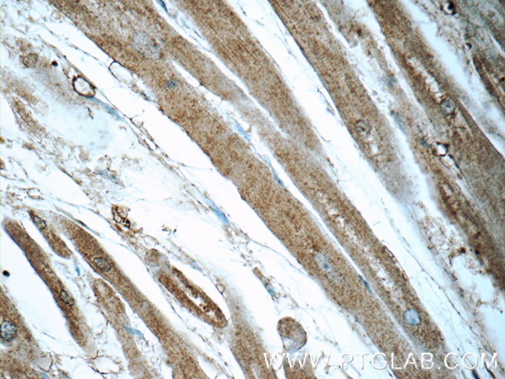 Immunohistochemistry (IHC) staining of human heart tissue using PFKP Polyclonal antibody (13389-1-AP)