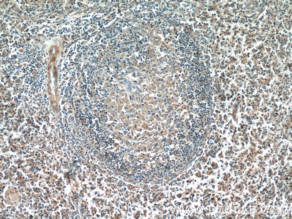 Immunohistochemistry (IHC) staining of human spleen tissue using PFKP Polyclonal antibody (13389-1-AP)