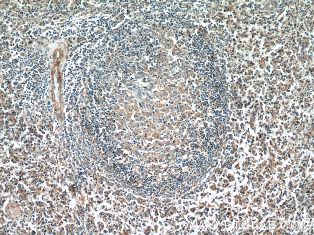 IHC staining of human spleen using 13389-1-AP