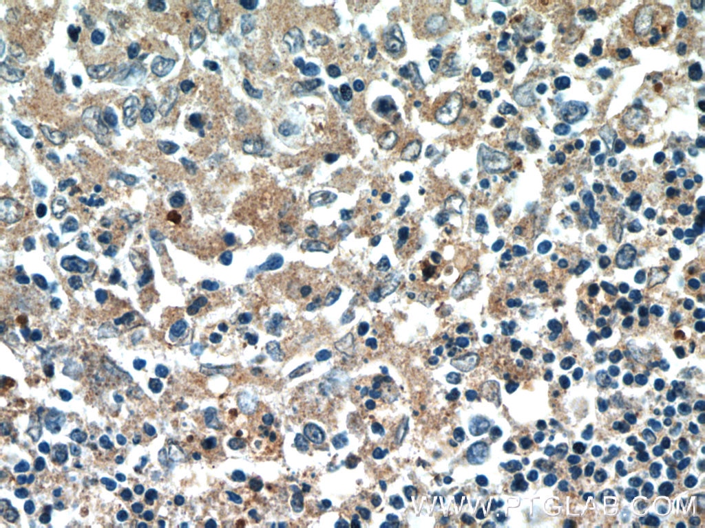 IHC staining of human spleen using 13389-1-AP