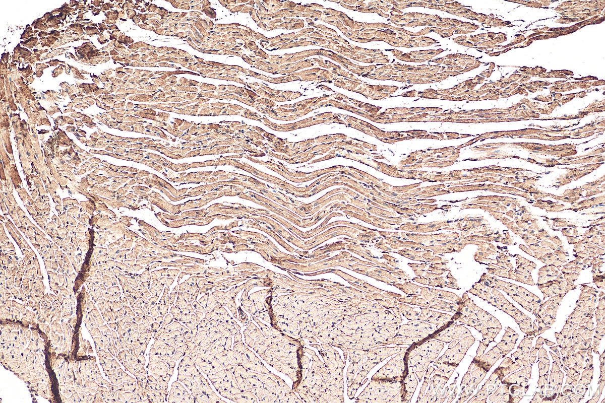 Immunohistochemistry (IHC) staining of mouse heart tissue using PFKP Polyclonal antibody (13389-1-AP)