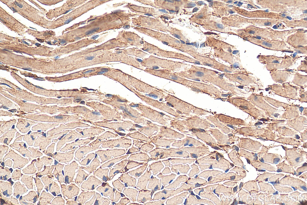 Immunohistochemistry (IHC) staining of mouse heart tissue using PFKP Polyclonal antibody (13389-1-AP)