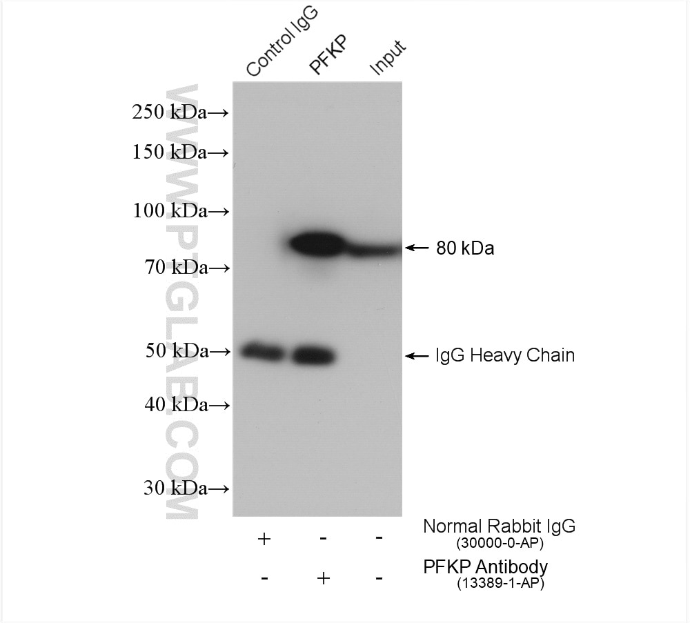 Immunoprecipitation (IP) experiment of Jurkat cells using PFKP Polyclonal antibody (13389-1-AP)