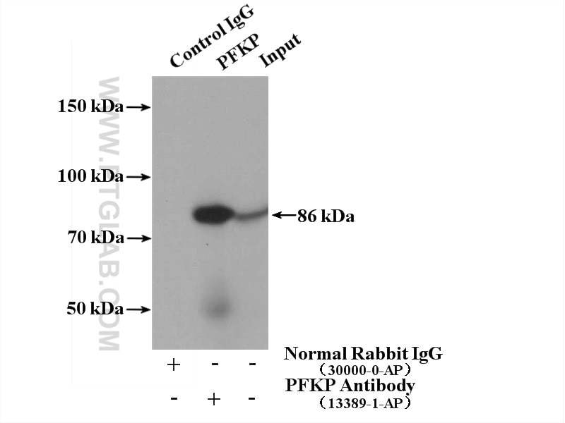 Immunoprecipitation (IP) experiment of mouse heart tissue using PFKP Polyclonal antibody (13389-1-AP)