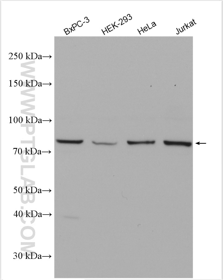 Western Blot (WB) analysis of various lysates using PFKP Polyclonal antibody (13389-1-AP)