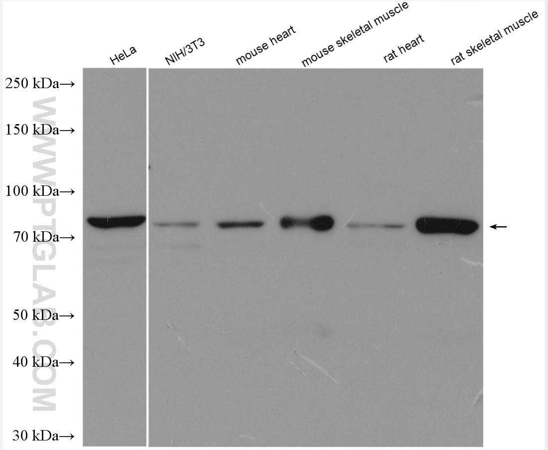 Western Blot (WB) analysis of various lysates using PFKP Polyclonal antibody (13389-1-AP)