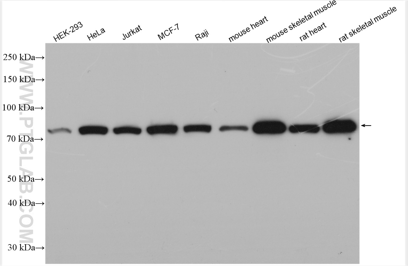Western Blot (WB) analysis of various lysates using PFKP Polyclonal antibody (13389-1-AP)