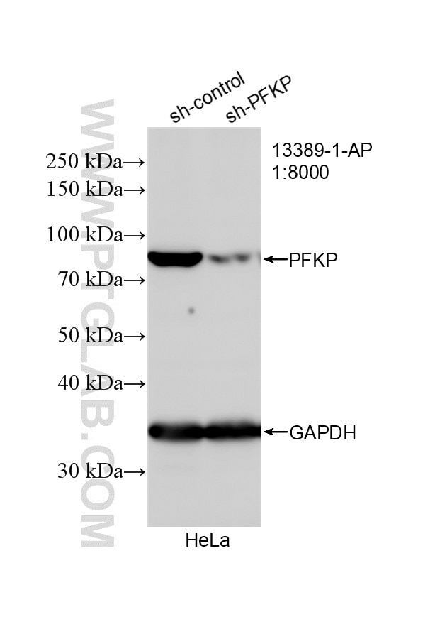 Western Blot (WB) analysis of HeLa cells using PFKP Polyclonal antibody (13389-1-AP)