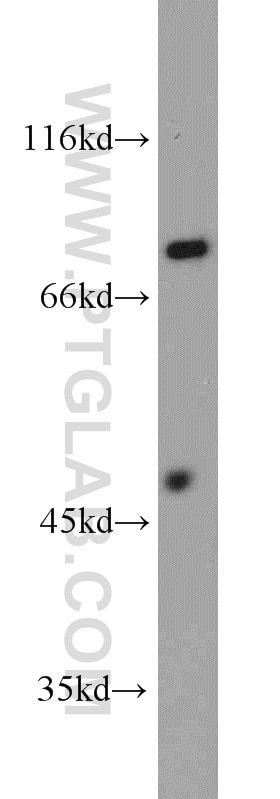 PFKP Polyclonal antibody