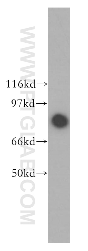 Western Blot (WB) analysis of human heart tissue using PFKP Polyclonal antibody (13389-1-AP)