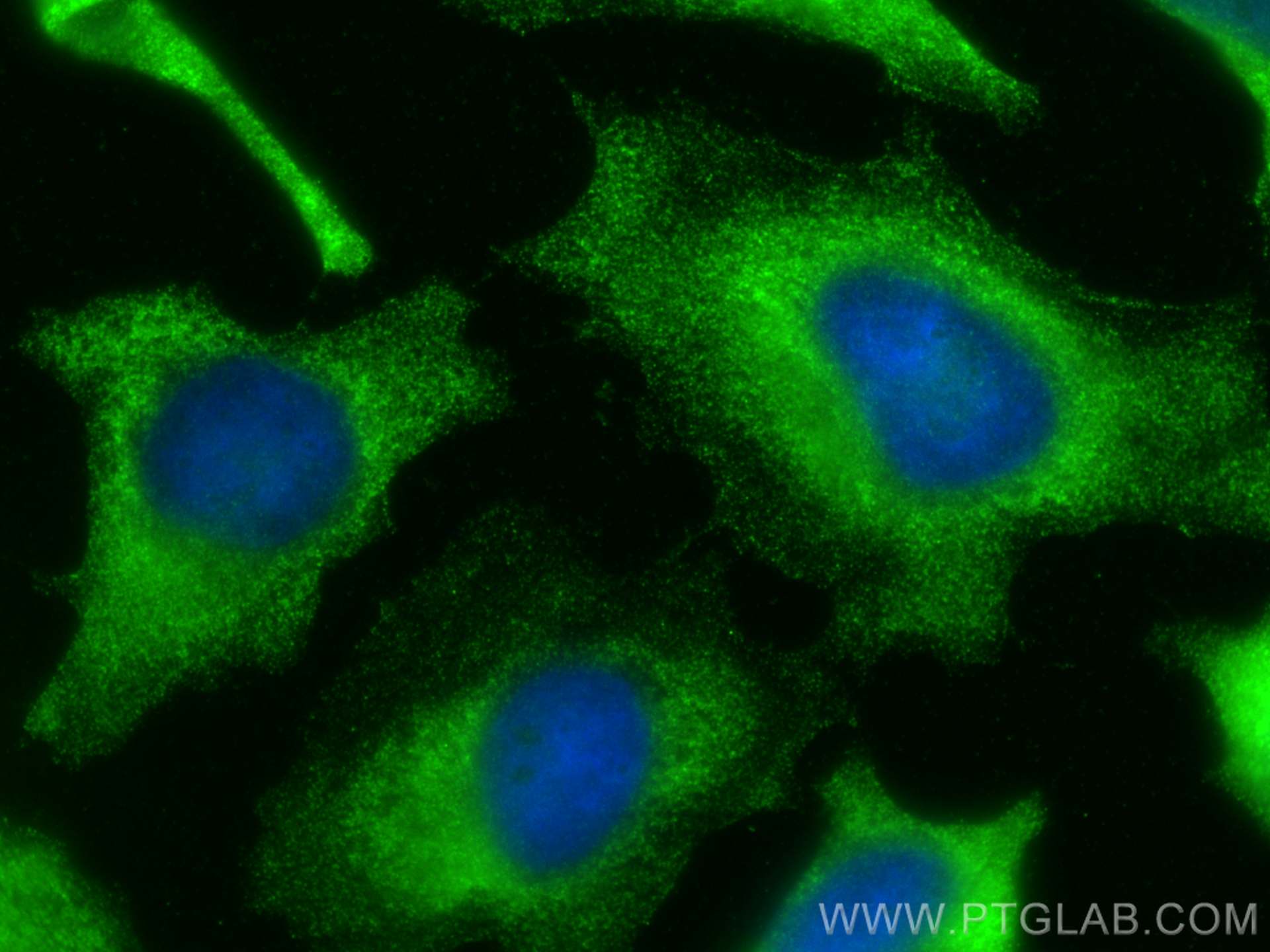 Immunofluorescence (IF) / fluorescent staining of HeLa cells using PFKP Monoclonal antibody (68129-1-Ig)