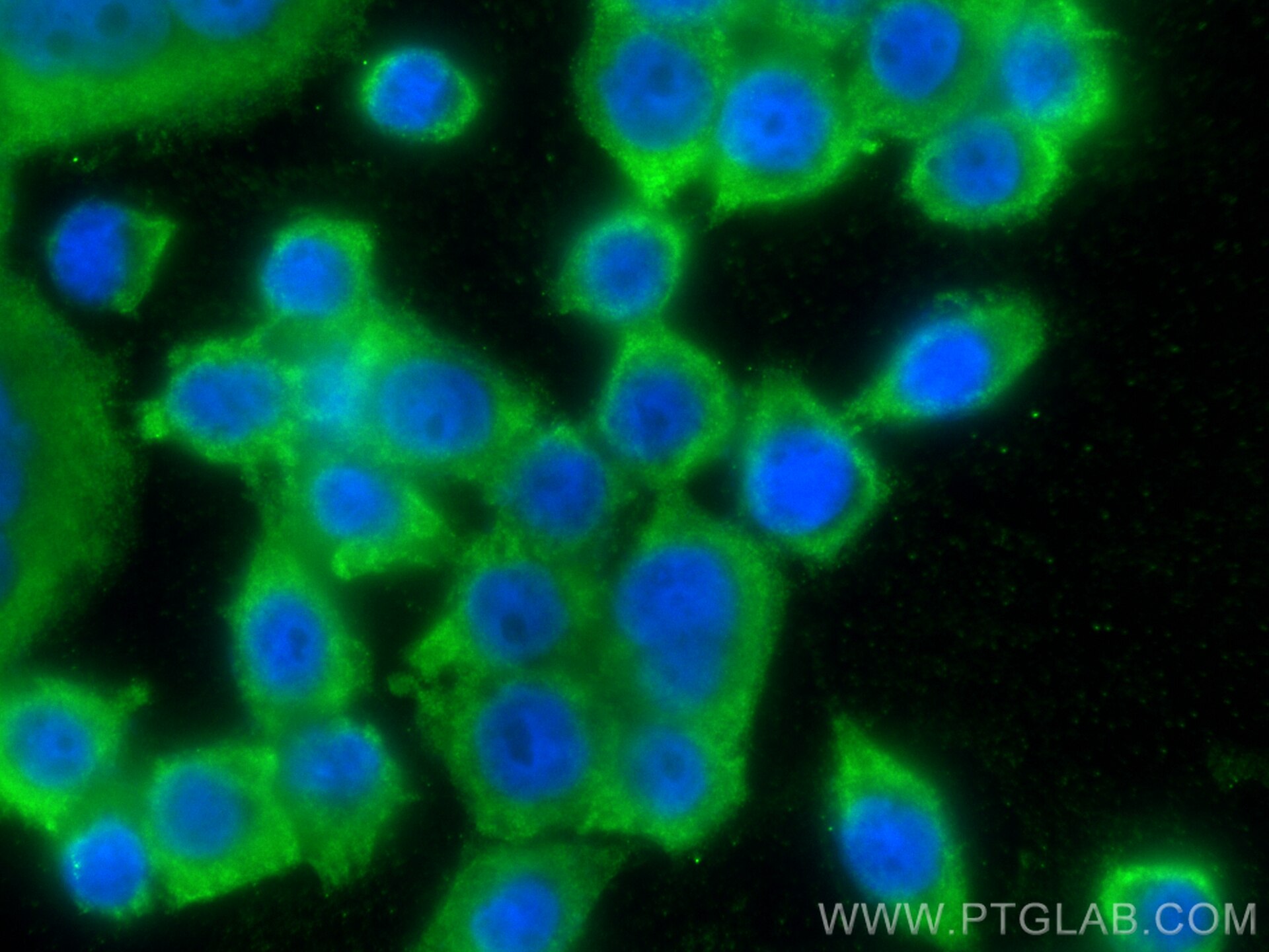 Immunofluorescence (IF) / fluorescent staining of BxPC-3 cells using PFKP Monoclonal antibody (68129-1-Ig)
