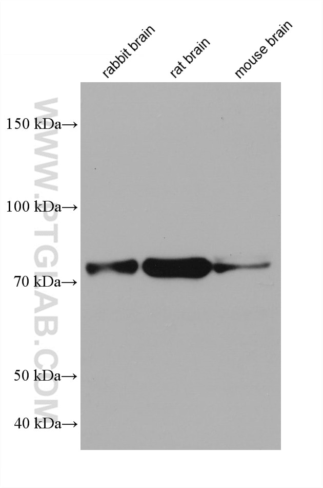 Western Blot (WB) analysis of various lysates using PFKP Monoclonal antibody (68129-1-Ig)