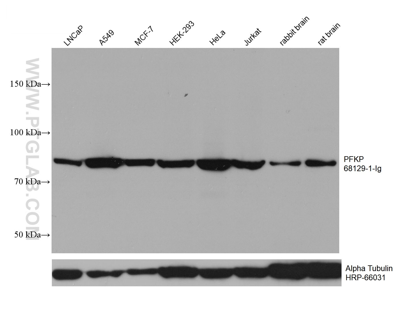 Western Blot (WB) analysis of various lysates using PFKP Monoclonal antibody (68129-1-Ig)