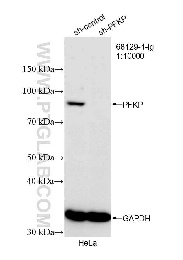 Western Blot (WB) analysis of HeLa cells using PFKP Monoclonal antibody (68129-1-Ig)