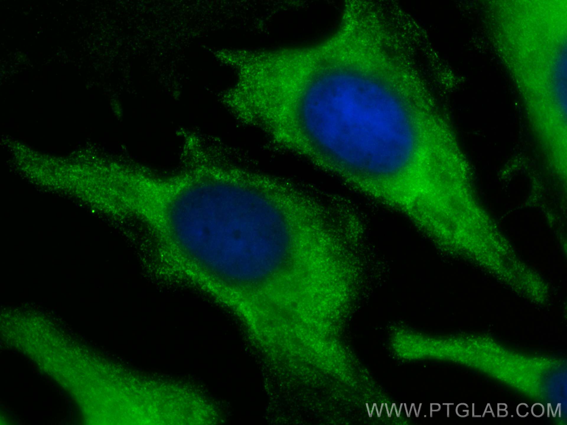 Immunofluorescence (IF) / fluorescent staining of HeLa cells using CoraLite® Plus 488-conjugated PFKP Monoclonal anti (CL488-68129)